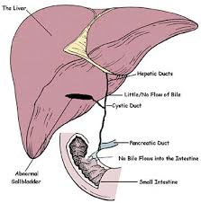 Biliary Atresia: A primer for Hopeful Outcomes